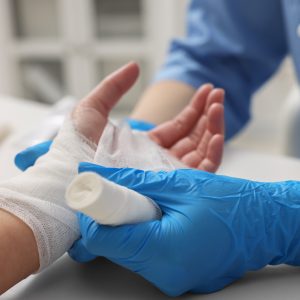 Doctor bandaging patient's burned hand in hospital, closeup